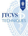 Jtcvs Techniques